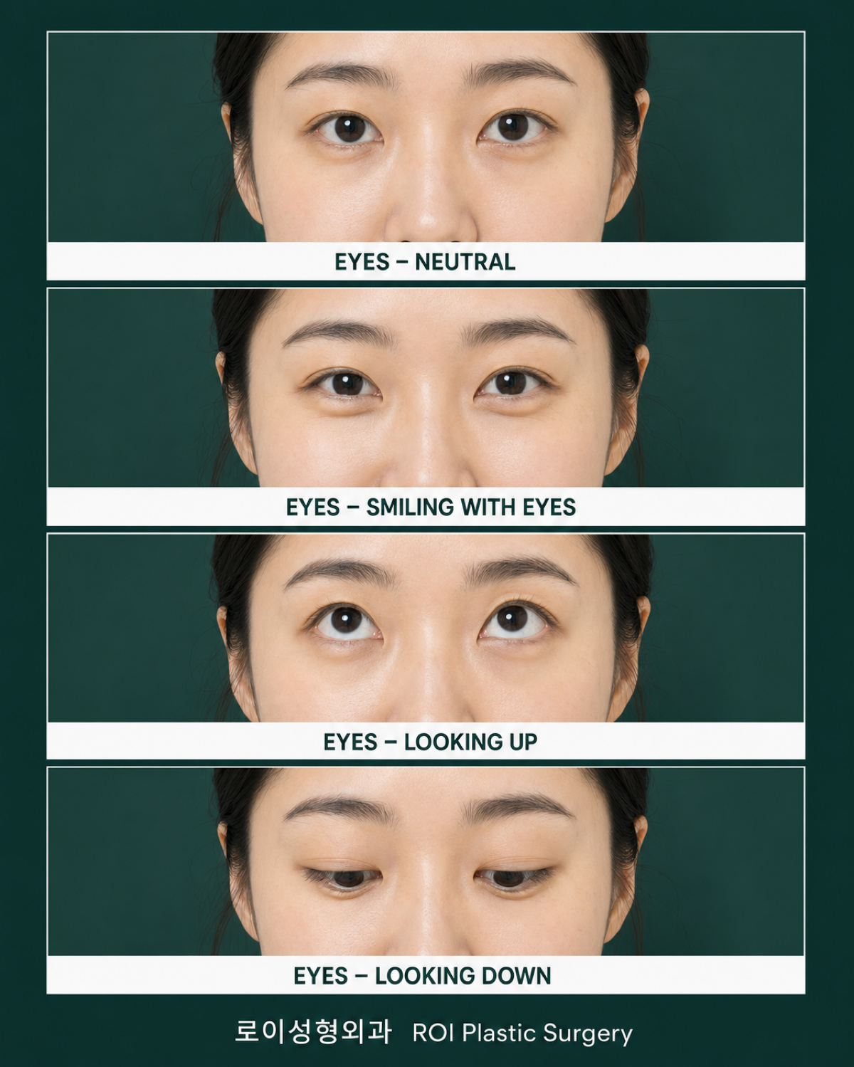 Photo guide for eye surgery consultation (close-up angles)