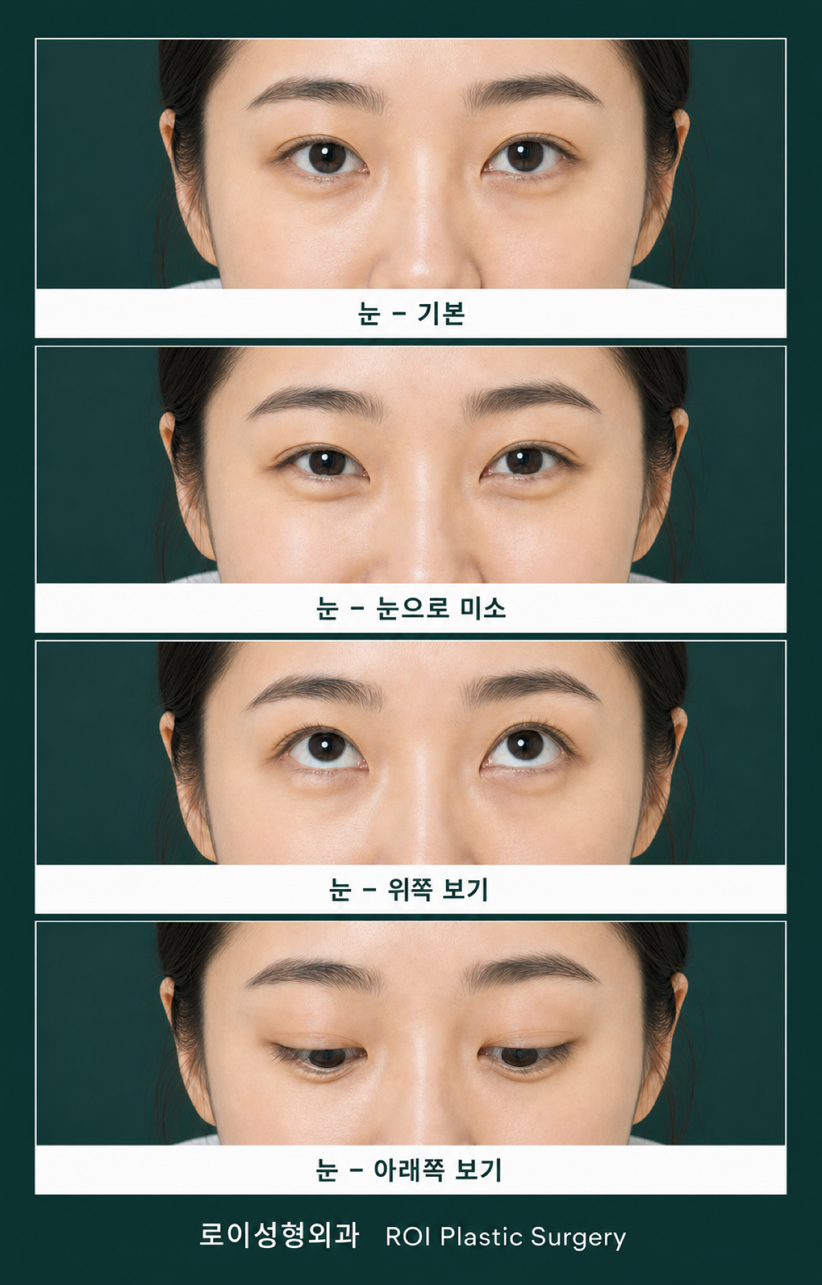 눈 수술 상담용 사진 촬영 가이드 (눈 부위 각도별)